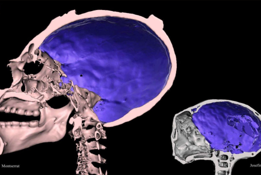 Real or Hoax: What CT Scans Actually Show